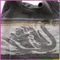 New wholesale cheap children angora and nylon winter warm sweater dresses